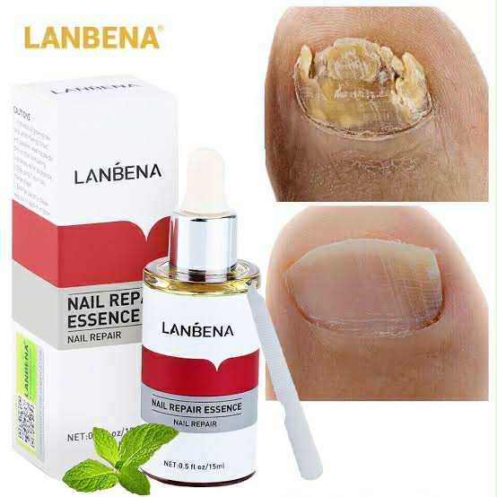 LANBENA Nail Repair Essence Serum-15ml